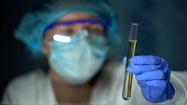Lab worker holding test tube with urine sample, health check, medical analysis
